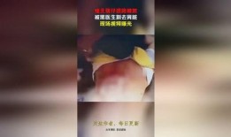缅北 医生爆料视频最新,战地医院的真实写照